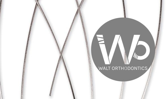 What Are Arch Wires and How Do They Work?