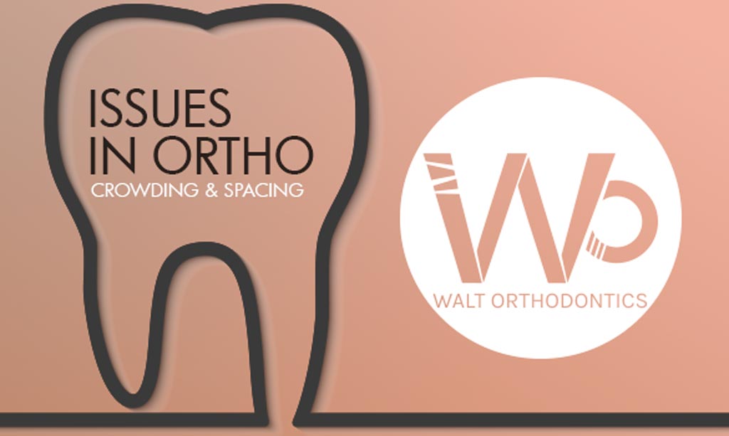 Learning to Spot Orthodontic Issues. Episode 1. Crowding and Spacing