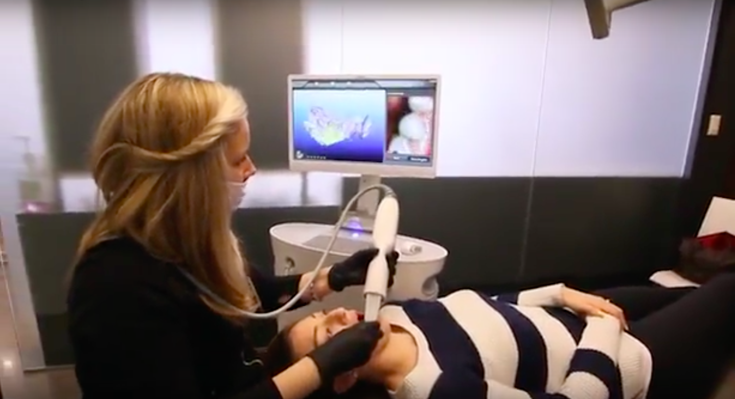 Itero 3D Scanning at Walt Orthodontics