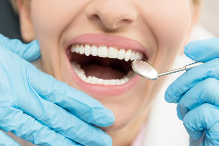 Understanding Interproximal Reduction [FAQ]