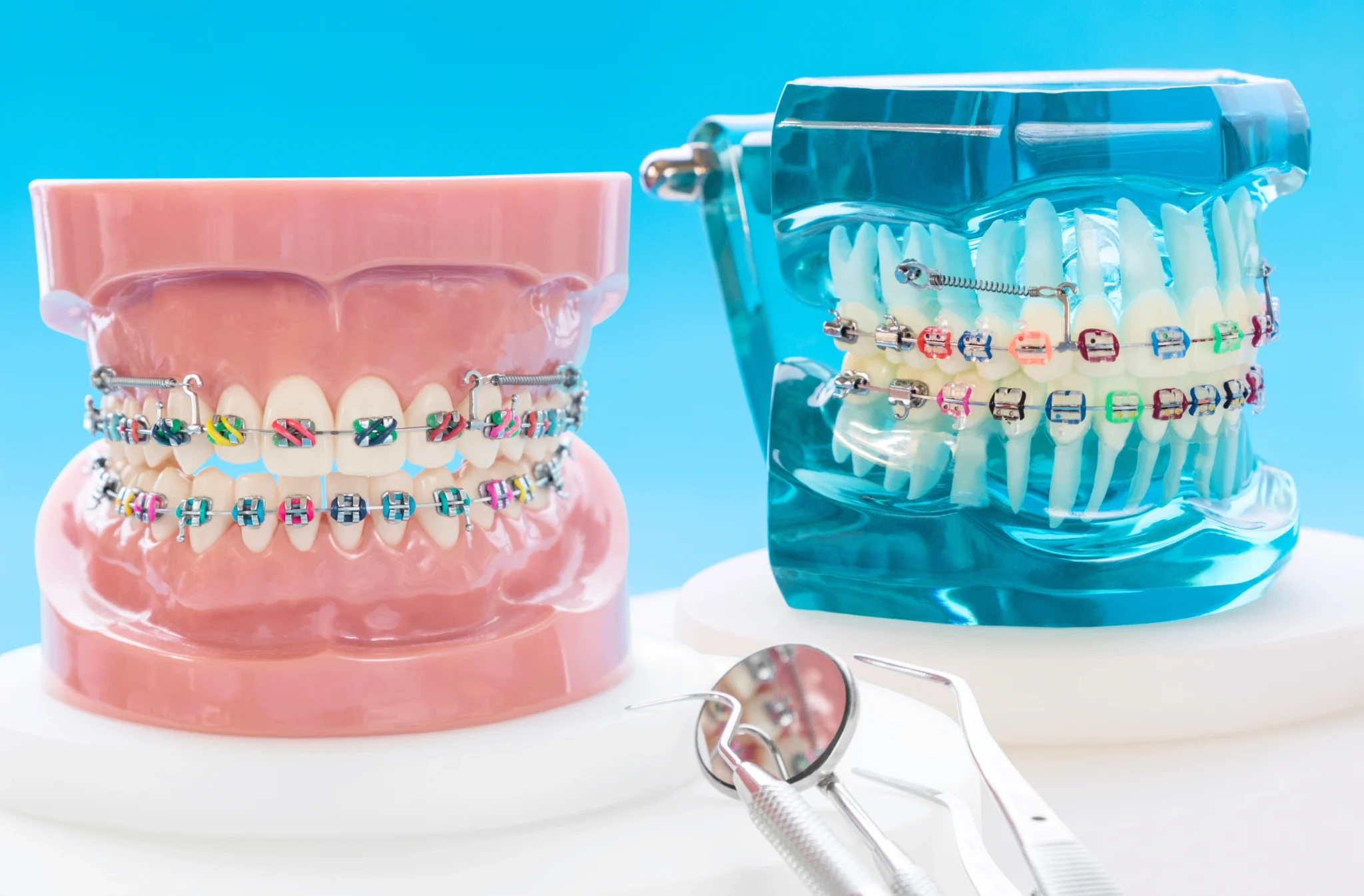 How Much Do Braces Cost?  Lakemoor Dental & Orthodontics